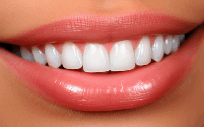 Polier Dental